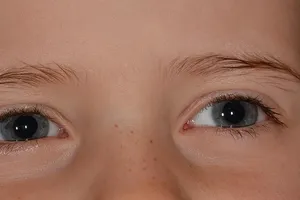 sss